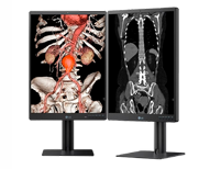 Monitores de Diagnóstico