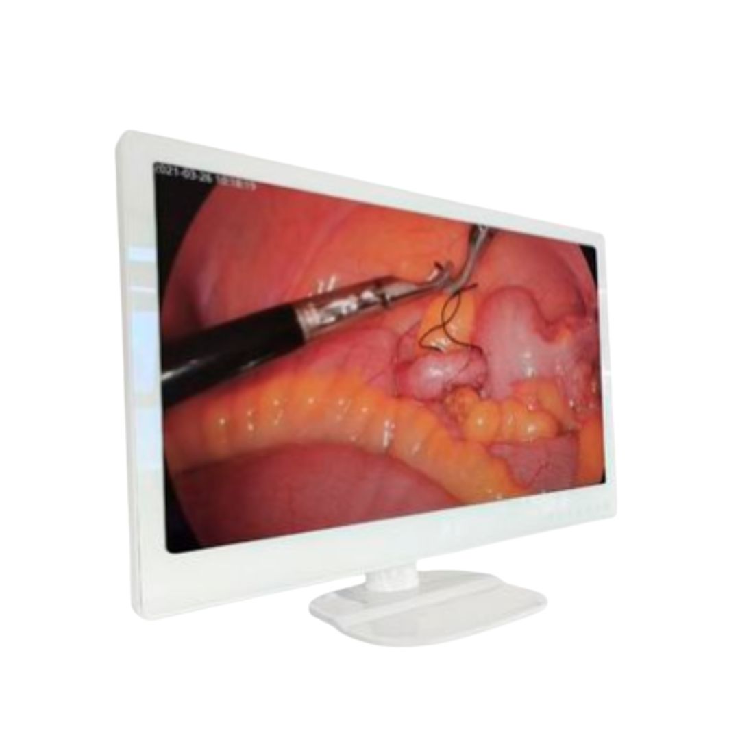 Monitor para Endoscopia